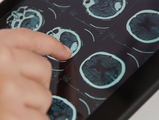 Neuromarketing de YouTube Video y neuromarketing